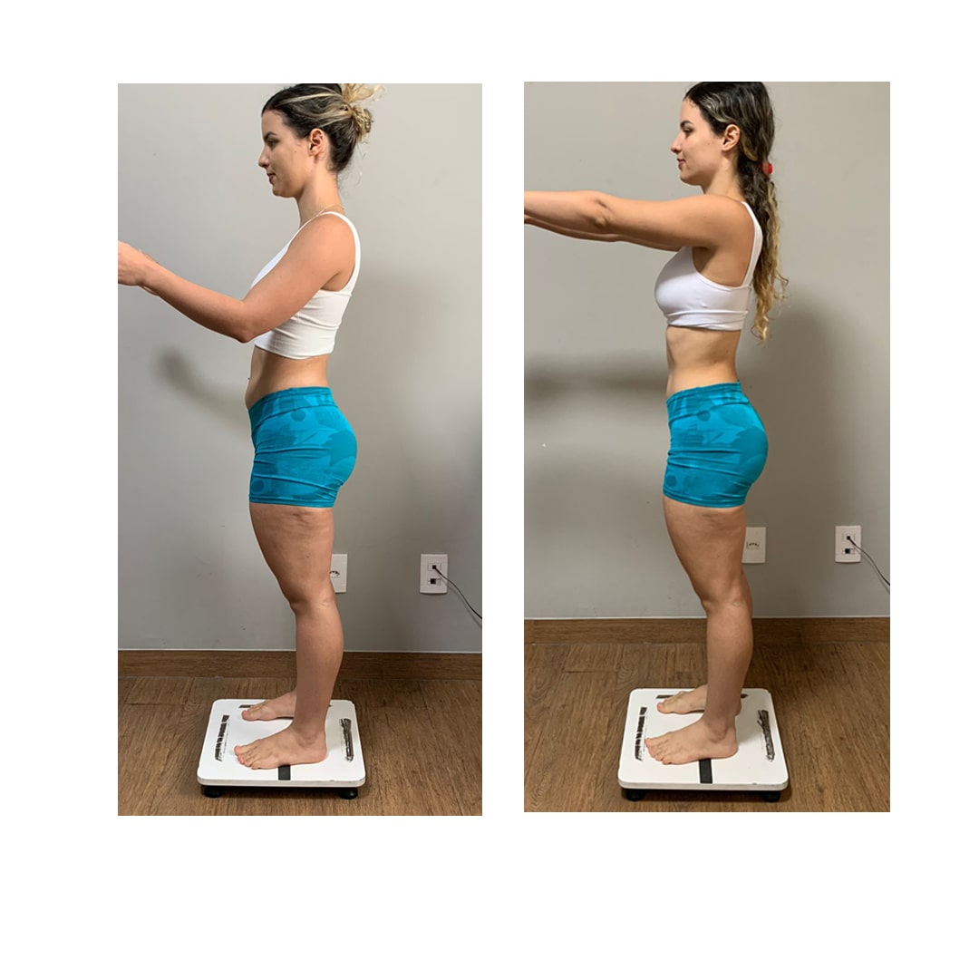 ANTES-E-DEPOIS-5-min-1.jpg