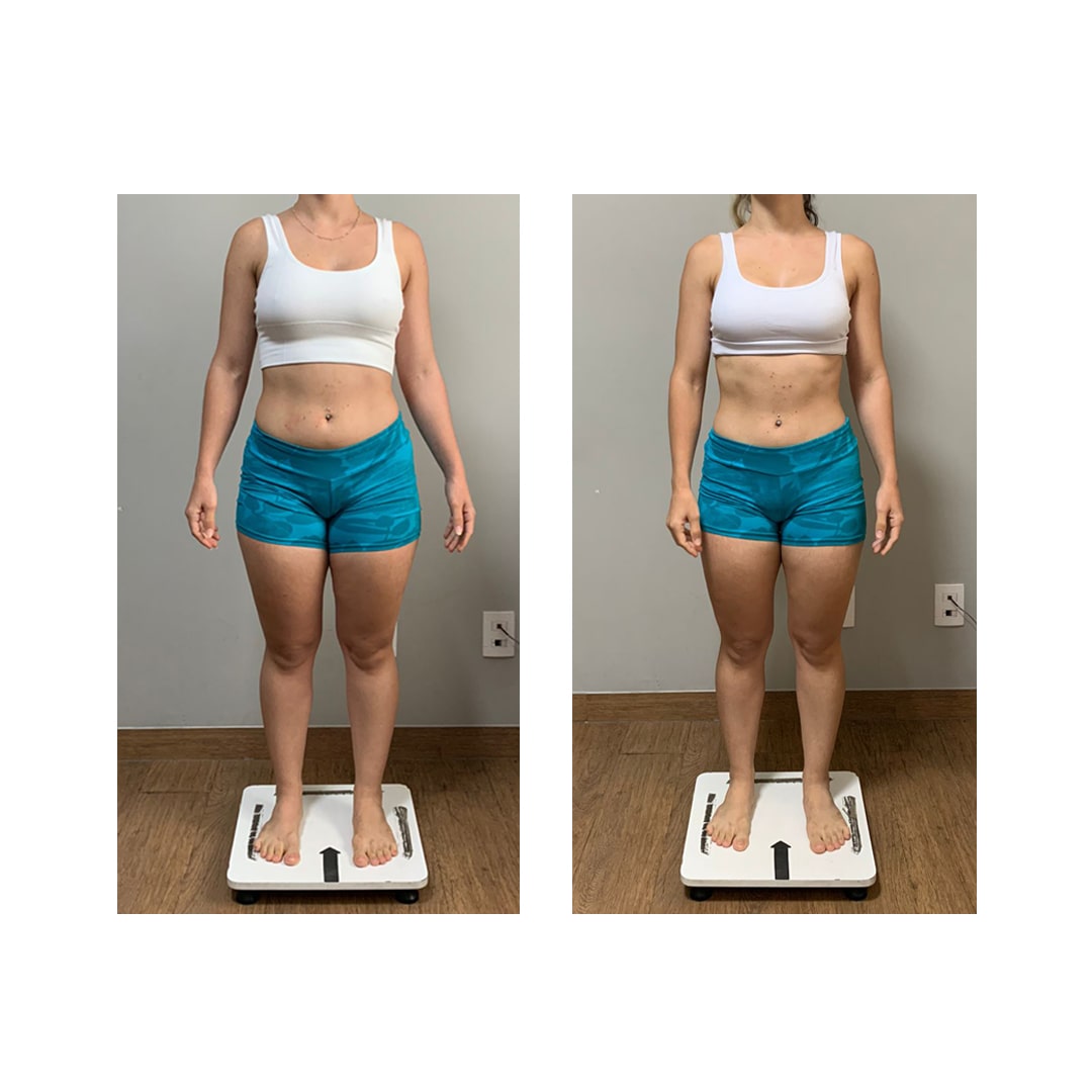 ANTES-E-DEPOIS-6-min-1.jpg