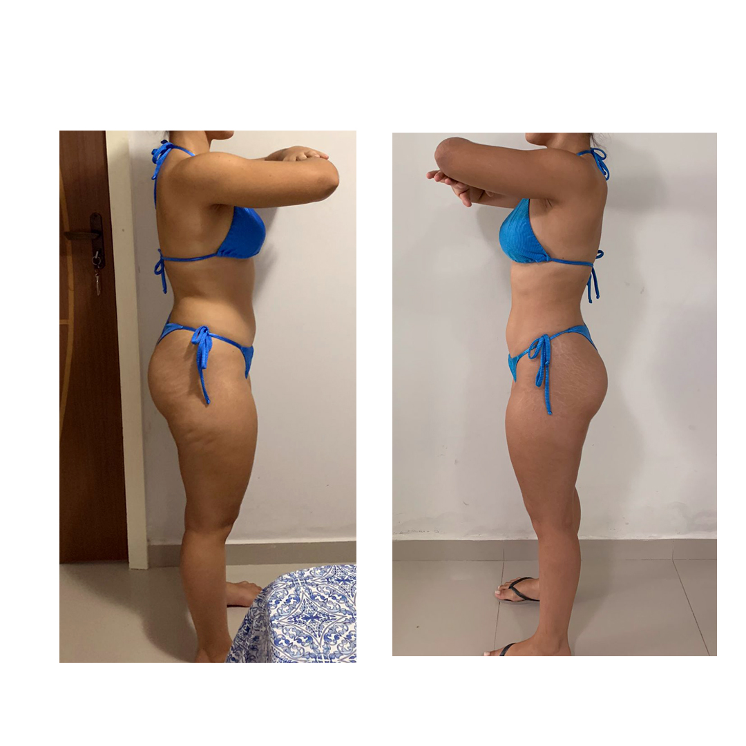 ANTES E DEPOIS - MARI